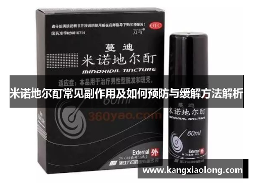 米诺地尔酊常见副作用及如何预防与缓解方法解析 米诺地尔酊常见副作用及如何预防与缓解方法解析